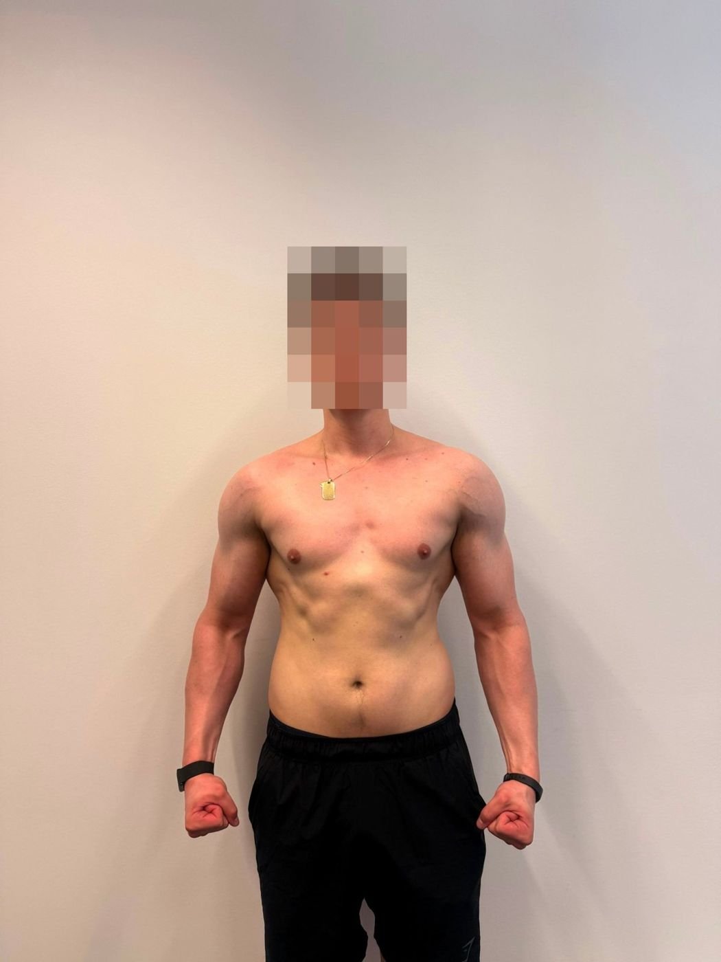 Klient B nach 30 Tagen